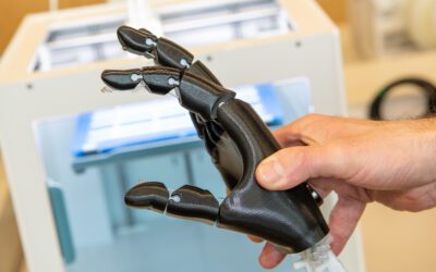 3D-Druck in der Orthopädietechnik